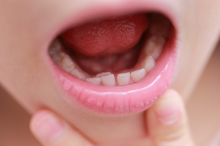 子供の歯（乳歯）について